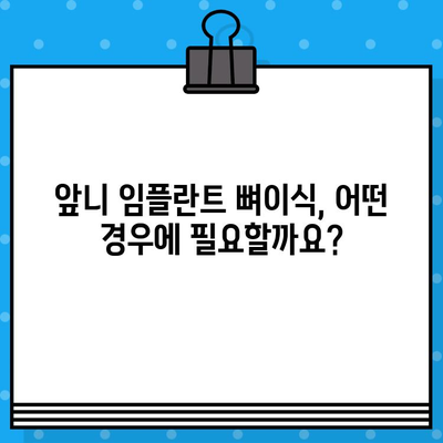 앞니 임플란트 뼈이식, 꼭 필요할까요? | 앞니 임플란트, 뼈이식, 치아 상실, 치과, 임플란트