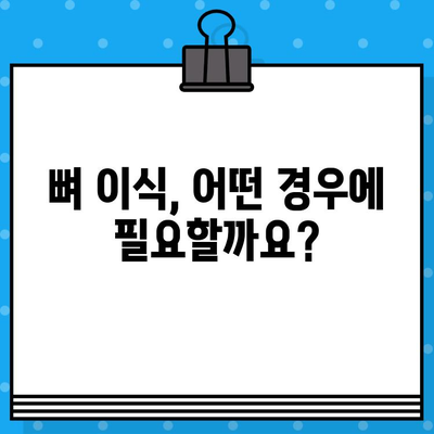 어금니 임플란트 뼈 이식 비용, 얼마나 들까요? | 가격, 견적, 정보