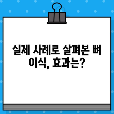 임플란트 뼈 이식, 꼭 필요할까요? 실제 사례 분석을 통해 알아보세요 | 임플란트, 뼈 이식, 치아 이식, 사례 연구