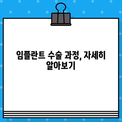 임플란트 수술 고민? 궁금한 모든 것을 해결해 드립니다 | 임플란트, 수술, 비용, 과정, 후기, 정보, 가이드