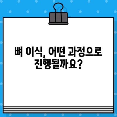 임플란트 궁금증? 뼈 이식, 이것만 알면 문제없어요! | 임플란트, 뼈 이식, 성공률, 치료 과정, 비용