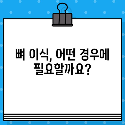 임플란트 성공의 필수 조건, 뼈 지주력 이식에 대한 모든 것 | 임플란트, 뼈이식, 지주력, 성공률, 질문과 답변