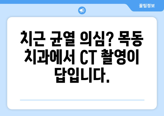 목동 치과에서 CT 촬영으로 잠재적 치근 균열 진단하기| 정확한 진단을 위한 필수 가이드 | 치근 균열, CT 촬영, 목동 치과, 진단