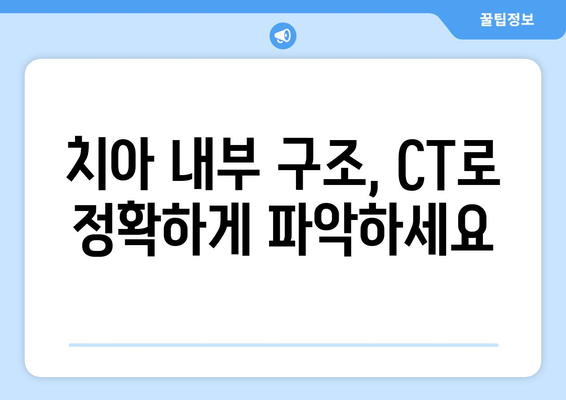 목동치과 근관치료 계획, CT촬영이 왜 중요할까요? | 근관치료, 치과 CT, 목동 치과