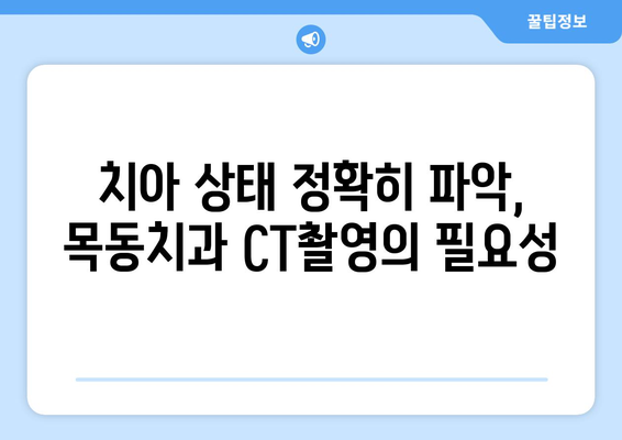 목동치과 CT촬영| 발치 시 주변 구조물 손상 예방 | 안전하고 정확한 발치, 목동치과에서 꼼꼼하게